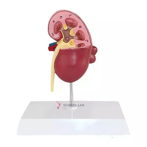 Renal Cyst Model