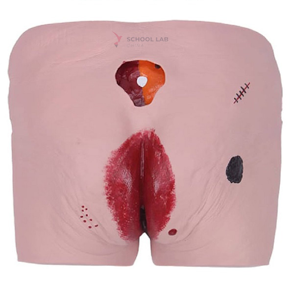 Decubitus Care Model