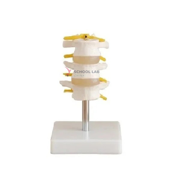Life Size Lumbar Vertebrae Model 3 pcs