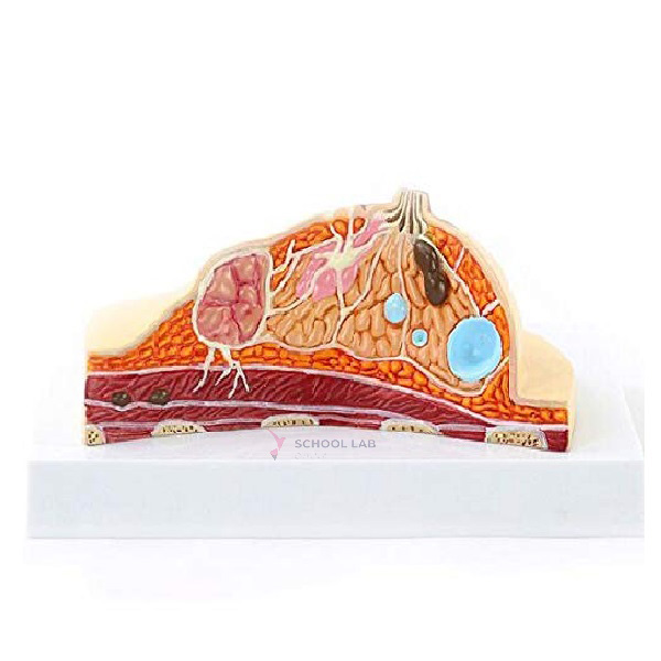 Breast Pathology Model