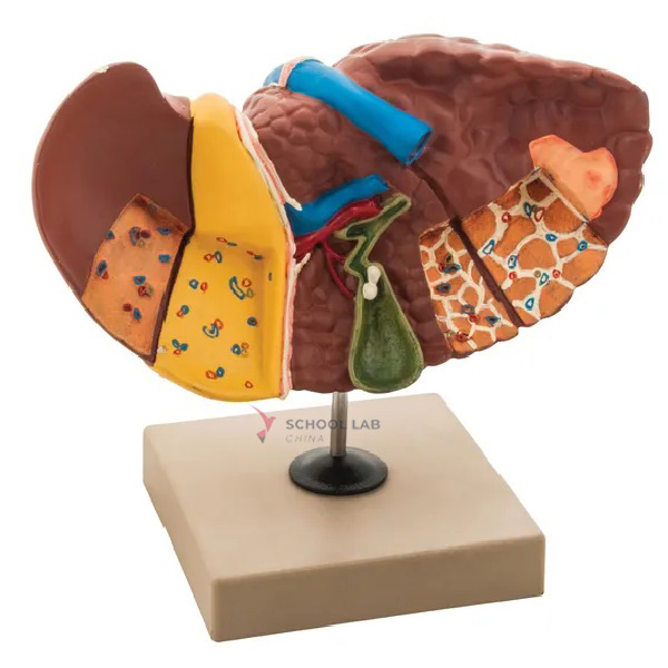 Pathology Liver Model