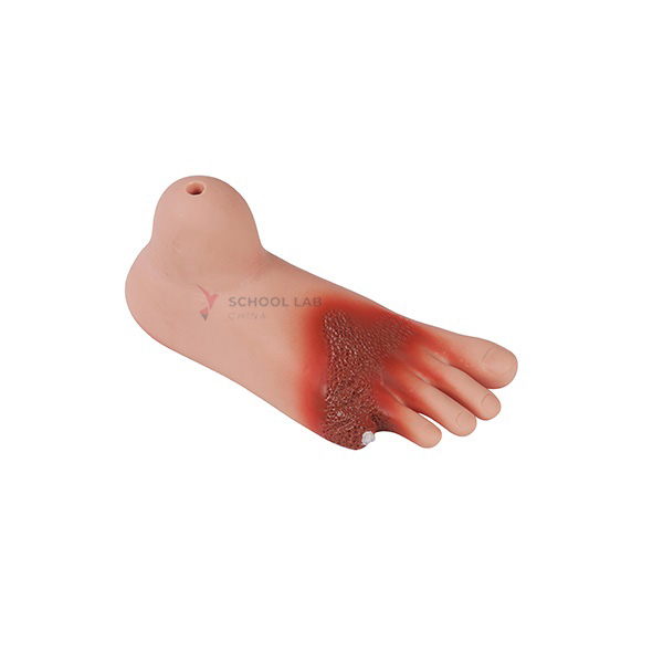 Diabetes Foot Model