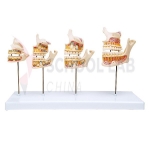 Dentition Development Model