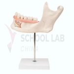 Half Lower Jaw